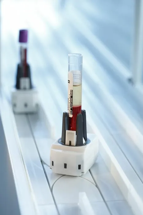 Bild 6: Automatisches Probenverteilsystem mit hoher Flexibilität: Es befördert jede Probe einzeln, da so eine flexible, individuelle und optimierbare Organisation einzelner Proben möglich ist. (Urheber: GLP Systems)